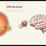 Photo Flash Exposes Hidden Threat The White Glow: Uncovering the Hidden Threat| Unveiling the childhood threat of Retinoblastoma! 👶🧬🚨