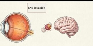 The White Glow: Uncovering the Hidden Threat| Unveiling the childhood threat of Retinoblastoma! 👶🧬🚨